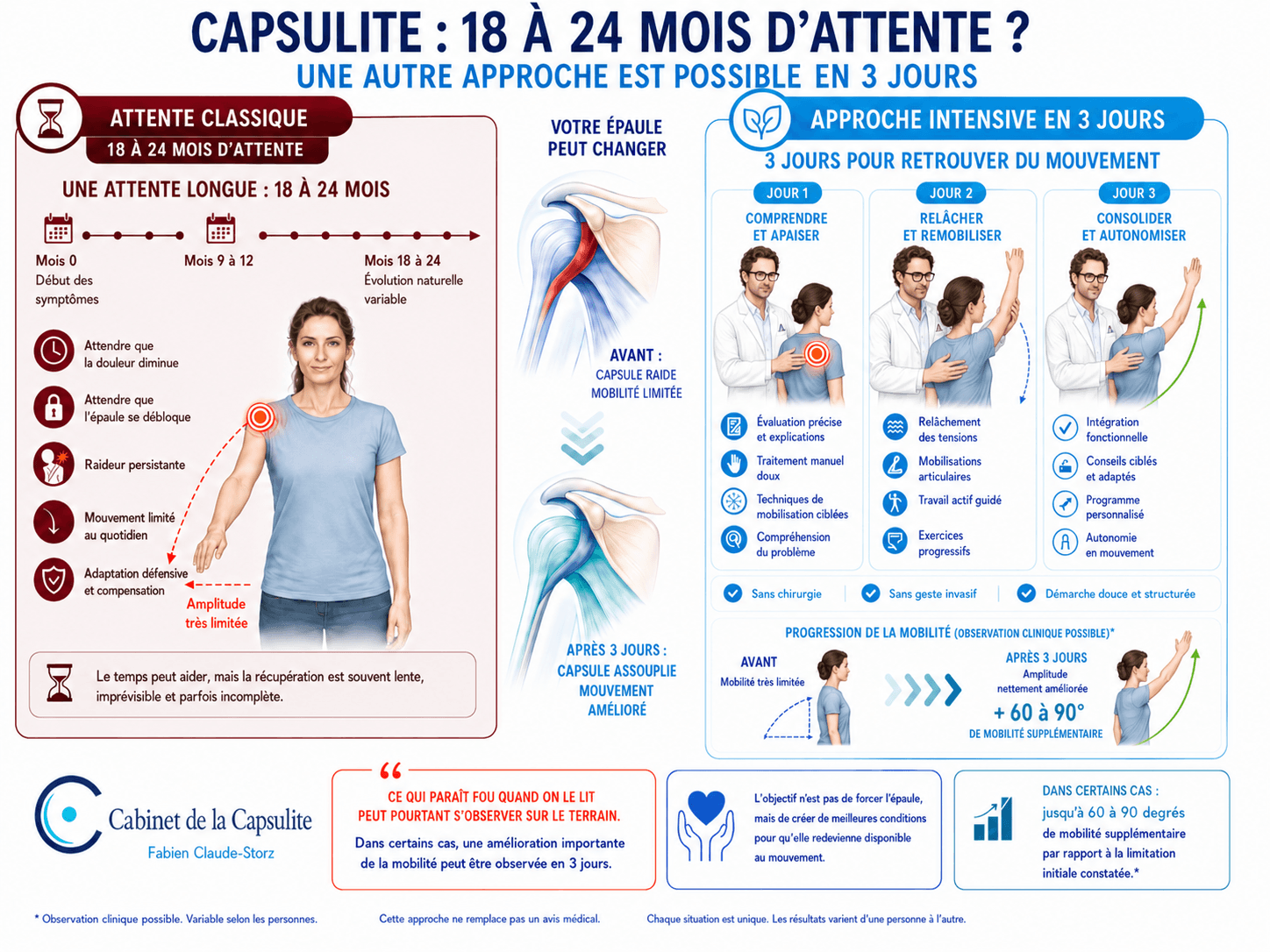 Schéma de la durée d'évolution de la capsulite rétractile et du protocole de libération en 3 jours