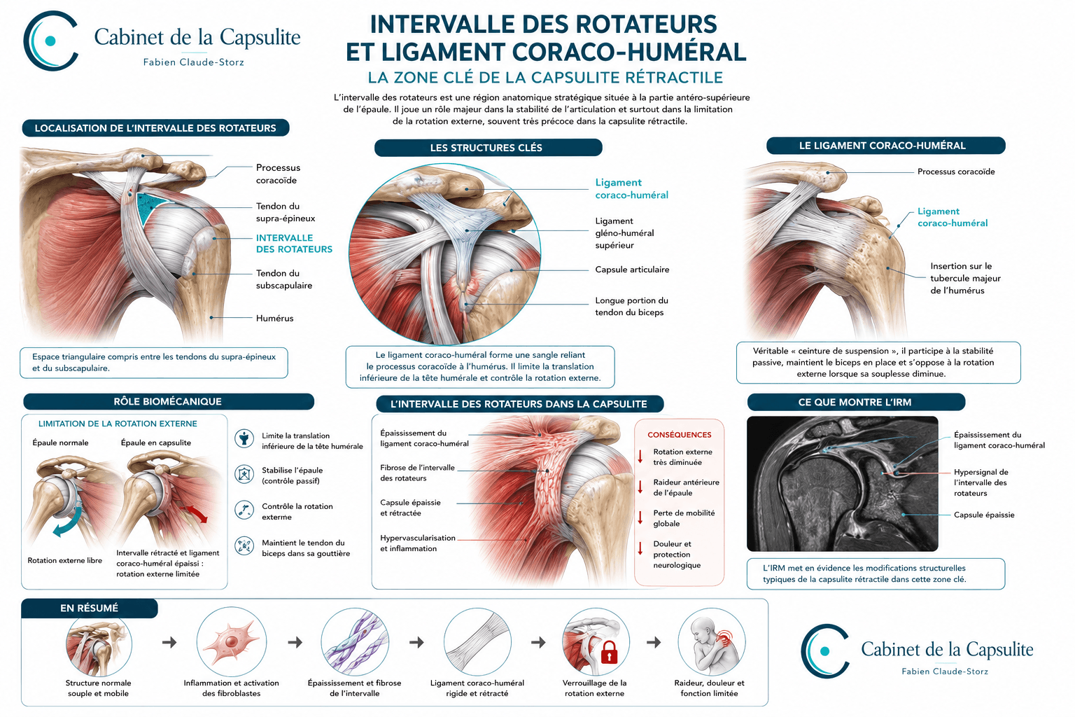 Anatomie de l'intervalle des rotateurs et du ligament coraco-huméral dans la capsulite rétractile